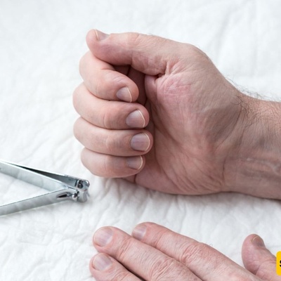 ما أسباب رائحه الأظافر الکریهه؟ وکیف یمکن التخلص منها بطرق سریعه وفعّاله؟