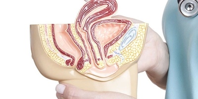 من آلام الظهر إلى سلس البول: أعراض أقل شهره للرحم المائل