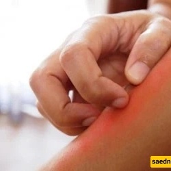 هل تعرف الحیله لإبعاد البعوض عن نفسک؟