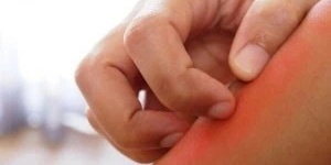 هل تعرف الحیله لإبعاد البعوض عن نفسک؟