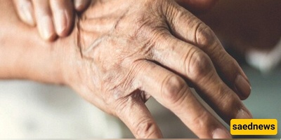 إیران تدخل المرحله الأولى من علاج مرض بارکنسون على الرئیسیات