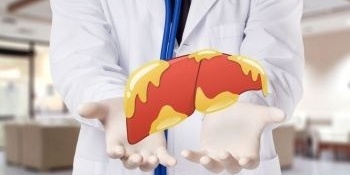 علاج الکبد الدهنی بمقطرات الهندباء والشاهترج العشبیه + طریقه استخدامها والتحذیرات المهمه