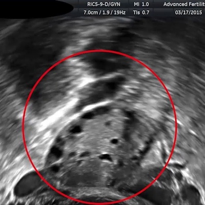 صوره موجات فوق صوتیه رائعه لقرده حامل