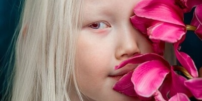 تعرفوا على الطفله الرائعه ذات العیون المتغیره باستمرار، والمعروفه باسم «طفله زال الثلجیه»—جمال فرید یأسر القلوب 😍