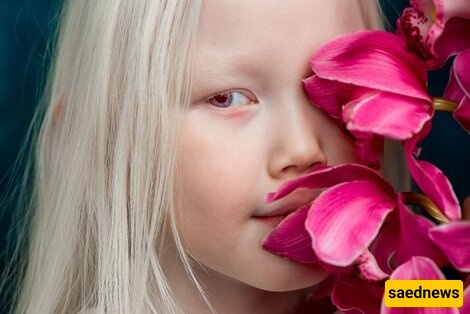 تعرفوا على الطفله الرائعه ذات العیون المتغیره باستمرار، والمعروفه باسم «طفله زال الثلجیه»—جمال فرید یأسر القلوب 😍