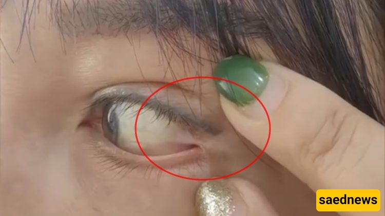 عین