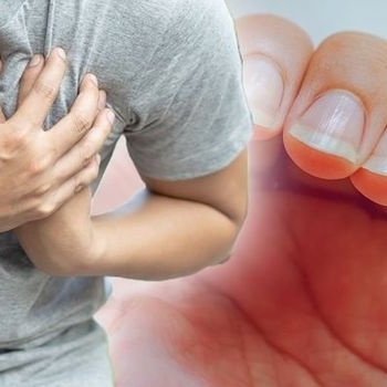 طبیب یکشف عن علامه مفاجئه فی الأظافر قد تشیر إلى مشکله قلبیه خطیره💔
