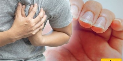طبیب یکشف عن علامه مفاجئه فی الأظافر قد تشیر إلى مشکله قلبیه خطیره💔
