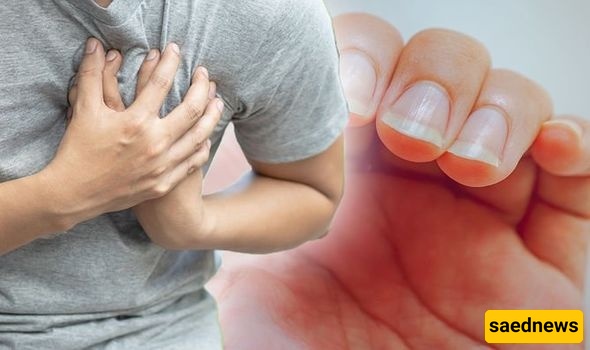 طبیب یکشف عن علامه مفاجئه فی الأظافر قد تشیر إلى مشکله قلبیه خطیره💔