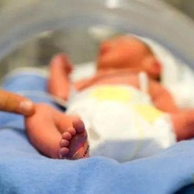 جنین یبتلع توأمه: عملیه جراحیه تزیل الجنین المتوفى