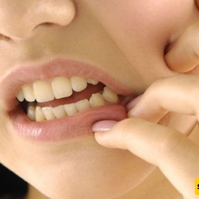 استخدامات قطرات دنتول والآثار الجانبیه لها