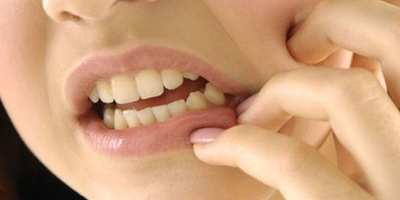 استخدامات قطرات دنتول والآثار الجانبیه لها