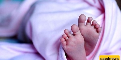 أغرب رضیع فی العالم یشبه کائناً فضائیاً یتحول إلى کابوس لوالدیه! 😱 +صور