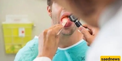 تحولت لسان هذا الرجل إلى الأخضر وبدأت شعره بالنمو! / نمو العشب الأخضر