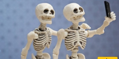 فتاه تبلغ من العمر 20 عامًا تعانی من حاله نادره بلا عظام فی جسدها! + صور مذهله