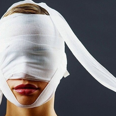 القصه المؤلمه لأجمل امرأه فی العالم بعد عملیات التجمیل