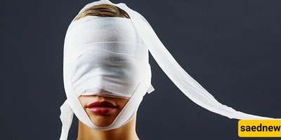 القصه المؤلمه لأجمل امرأه فی العالم بعد عملیات التجمیل