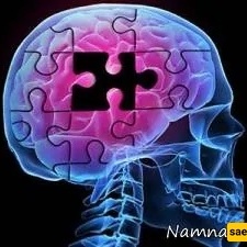 مرض ألزهایمر والفنانون