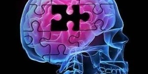 مرض ألزهایمر والفنانون