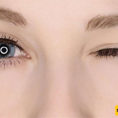 متى یکون ارتعاش الجفن خطیرًا؟