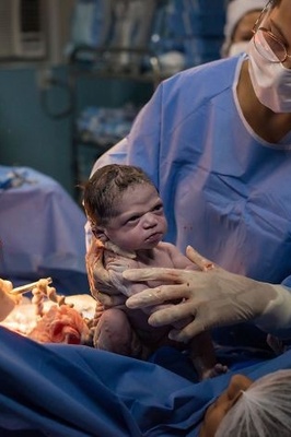 نظره هذا المولود الغریبه عند الولاده أصبحت حدیث العالم!