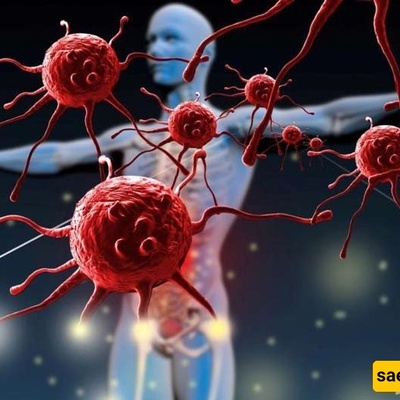 أسباب أمراض المناعه الذاتیه وطرق علاجها