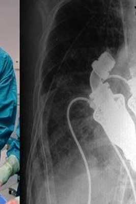 أوَحَدُ إنسان حی فی العالم بدون قلب