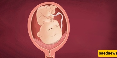 فهم المشیمه الهامشیه أو المشیمه المنزاحه أثناء الحمل