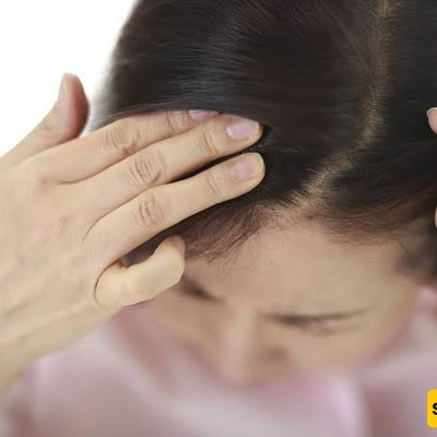 فهم أسباب تقشّر فروه الرأس وأعراضه وأفضل طرق علاجه