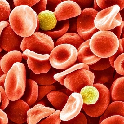 تم التعرف أخیرًا على فصیله الدم الغامضه التی کان الأطباء یبحثون عنها لسنوات!