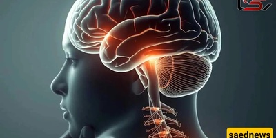 6 عوامل مهمه یمکن أن تؤدی إلى تفاقم التصلب المتعدد (MS)