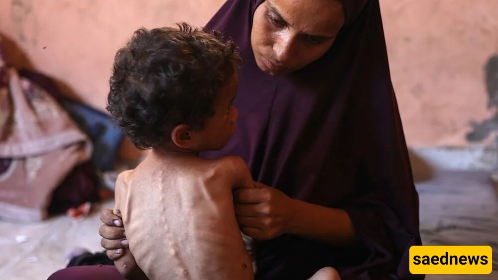 وزاره الصحه بغزه: ارتفاع عدد شهداء المجاعه وسوء التغذیه داخل القطاع إلى 222 شخصا