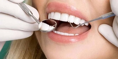 لماذا تتکسر حشوه الکمبوزیت السنی أو تتشقق؟ الأسباب وحلول الإصلاح