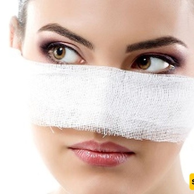 صدمه غریبه لامرأه شابه بعد عملیه تجمیل أنفها