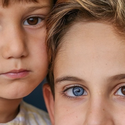 الألوان الممیزه لعیون شقیقین: أزرق وبنی
