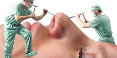الفتاه تخضع لأکثر من 30 عملیه تجمیل من أجل خطیبها