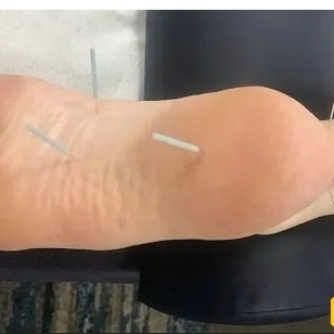 المرأه الغریبه التی تنزف المسامیر والإبر من ساقیها