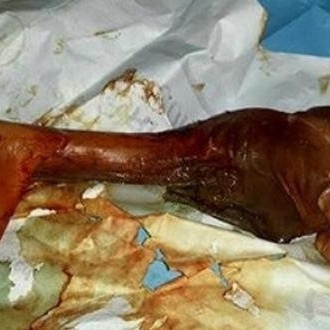 القصه الغریبه لامرأه أنجبت أرنبًا