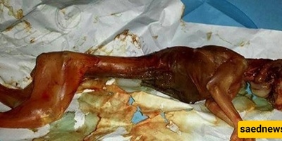 القصه الغریبه لامرأه أنجبت أرنبًا