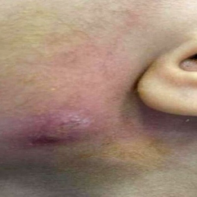 کیف تزیل دوده من وجه طفل یبلغ من العمر 8 سنوات (مع الصور)