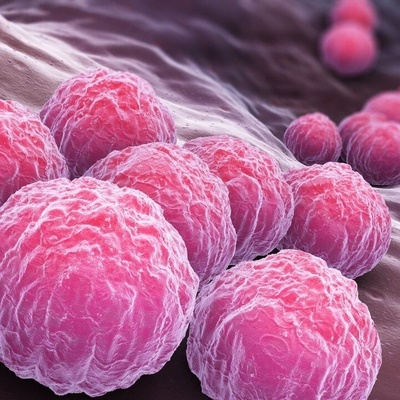 أفضل طرق علاج الثآلیل التناسلیه عند النساء والرجال