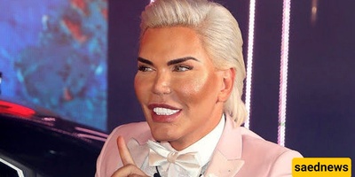 أخطر جراحه تجمیل للعین فی الهند: إلى أی حد یمکن أن تصل الحماقه؟