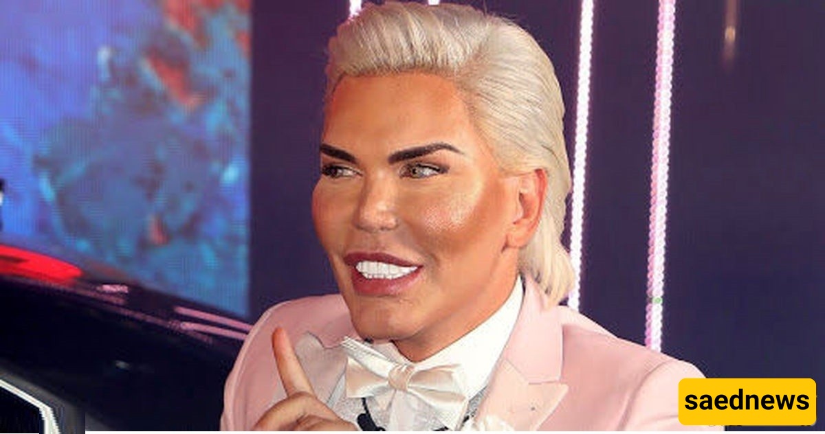 أخطر جراحه تجمیل للعین فی الهند: إلى أی حد یمکن أن تصل الحماقه؟