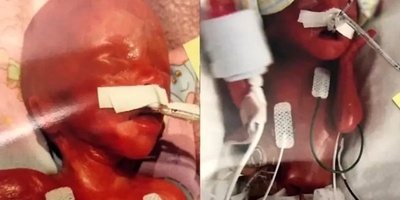 أغرب ولاده فی التاریخ: امرأه تلد تفاحه حمراء