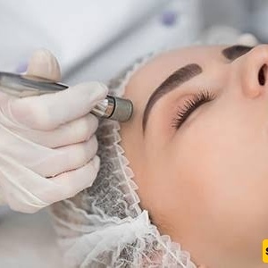 کیف تساعد تقنیه التقشیر الدقیق للجلد على تجدید البشره؟