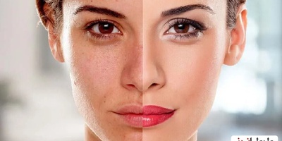 طرق معجزه لتفتیح البشره فی یوم واحد + نصائح للحصول على بشره ناعمه ومشرقه