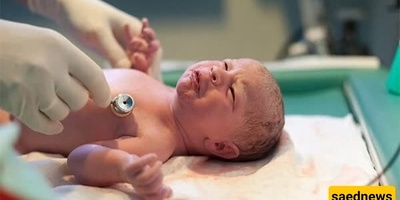 النساء الإیرانیات یرفضن الولاده الطبیعیه ویعتمدن الولاده القیصریه! + صور