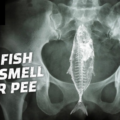 قصه سمکه تدخل المسالک البولیه ولا تستطیع الخروج