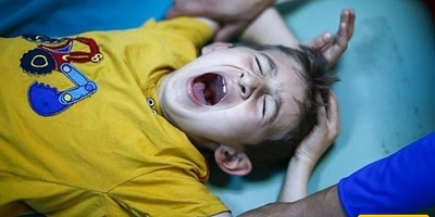 ما هو أفضل وقت وطریقه لختان الذکور؟