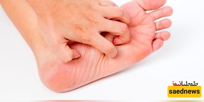 ماذا یشیر حکه القدمین فی اللیل؟